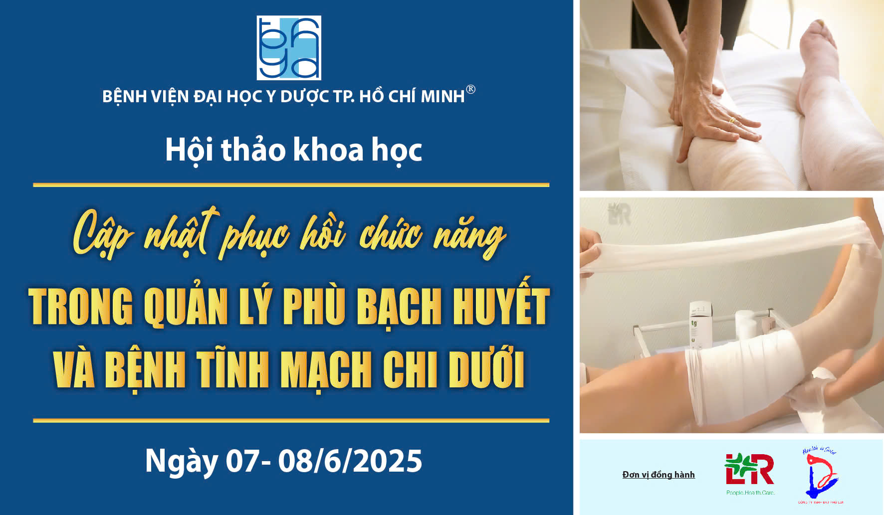 Cập nhật PHCN phù bạch huyết và bệnh tĩnh mạch chi dưới