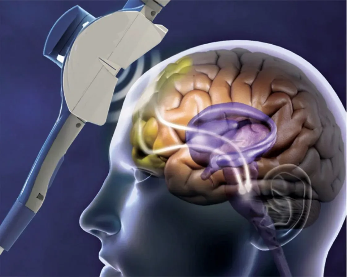 SWEEP và TMS – OS 3 Hội nghị Khoa học Phục hồi Chức năng 2025