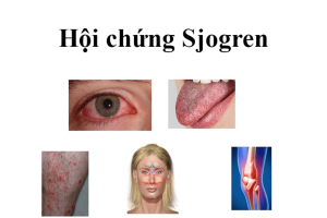 Người mắc hội chứng Sjogren cần lưu ý gì trong tập luyện?